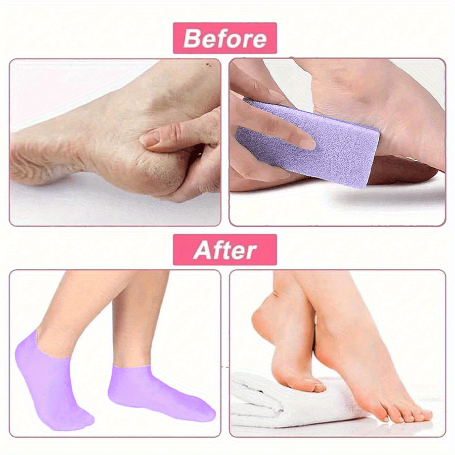 1 Pair Silicone Gel Foot Care Socks, Women's Moisturizing Anti-Crack Foot Socks, Suitable for Dry and Cracked Heels - Image 2