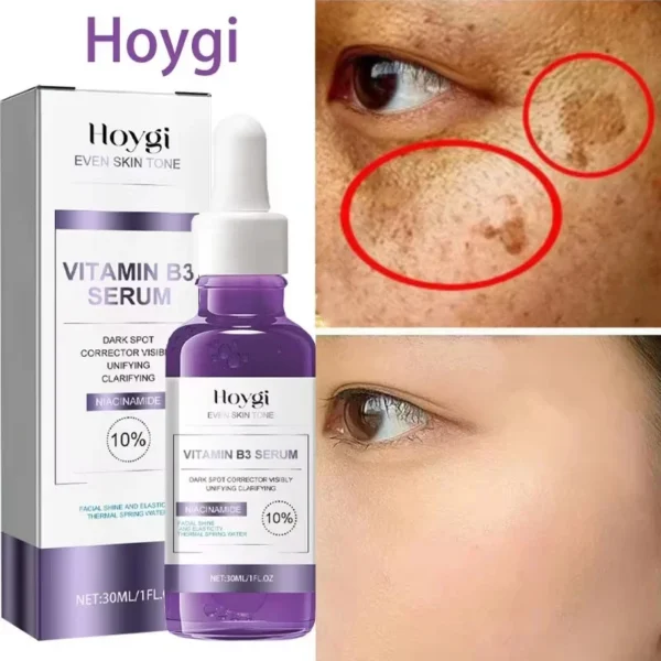 30ml Vitamin B3 Serum Niacinamide Anti-Aging Whitening Dark Spot Remover Moisturizing Korean Cosmetics for Acne And Melasma — Generic